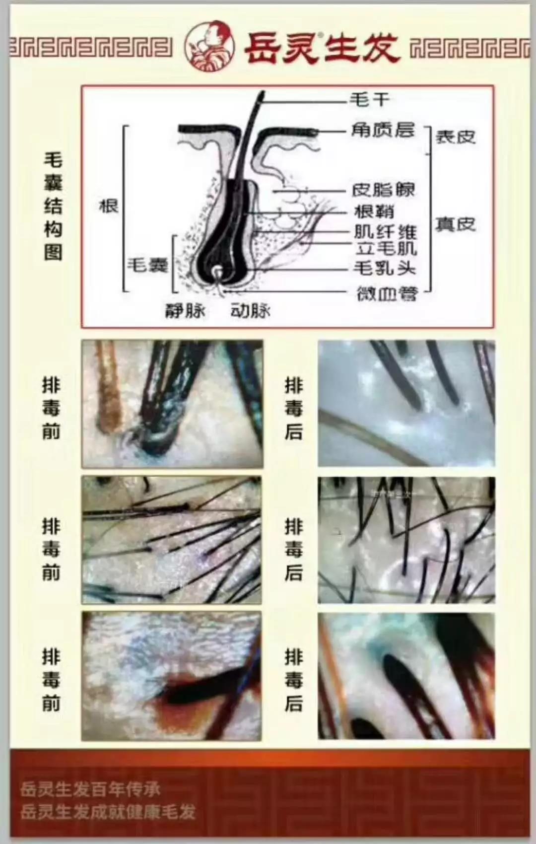 白發(fā)反復(fù)拔容易引發(fā)毛囊炎